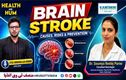 !برین اسٹروک (فالج) کی وجوہات، خطرات، علاج اورکیا ہیں بچاؤ کی تدابیر
